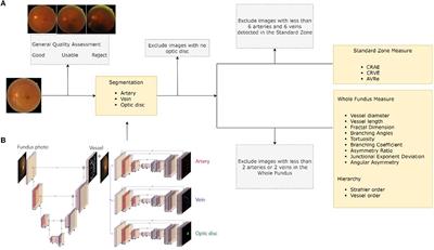 A Deep Learning System for Fully Automated Retinal Vessel Measurement in High Throughput Image Analysis